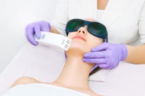 What's Up with that Chin Hair? | Romeo & Juliette Laser Hair Removal What's Up with that Chin Hair? | Romeo & Juliette Laser Hair Removal