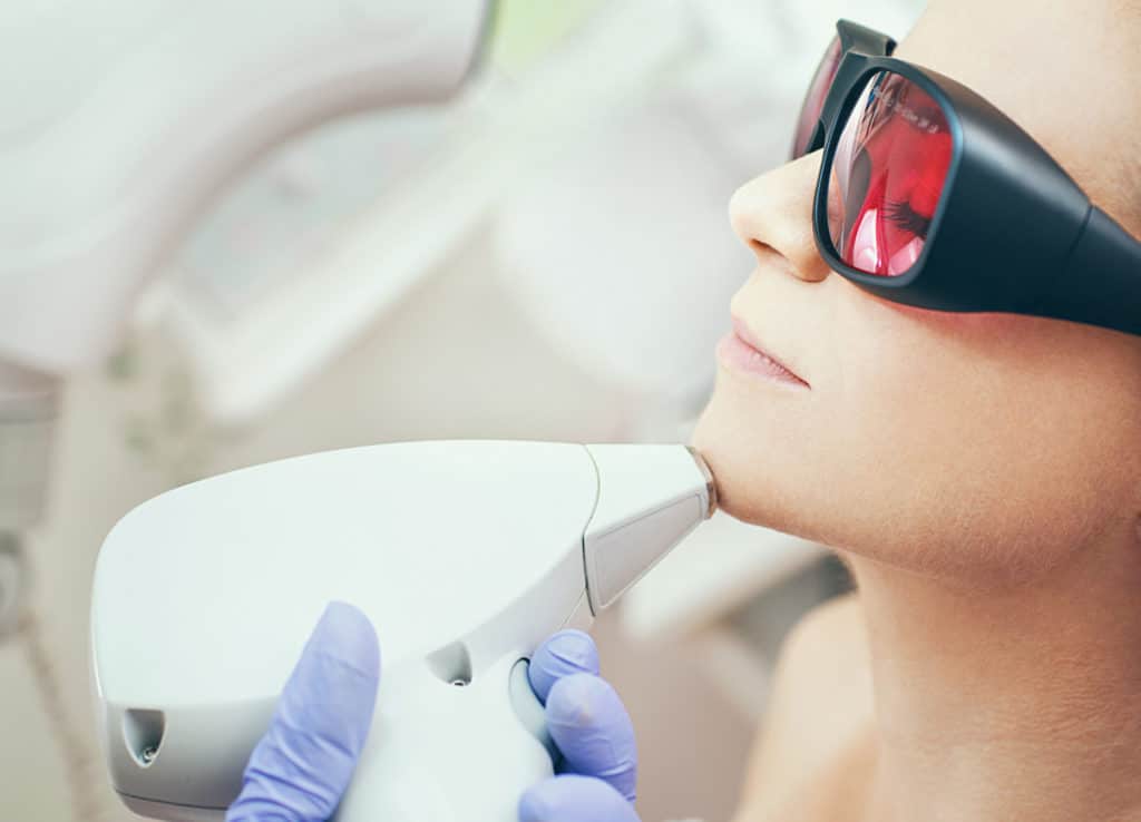 Laser Hair Removal On PCOS Hairs | PCOS Laser Hair Removal in NYC
