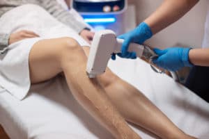 close up of legs in professional office, with doctor using laser hair removal machine