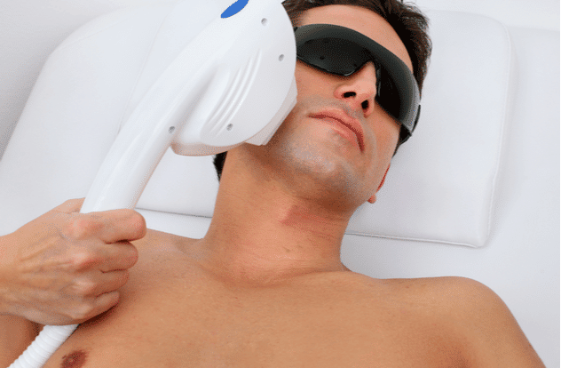 3 things to do before getting laser hair removal 6388ca2322380
