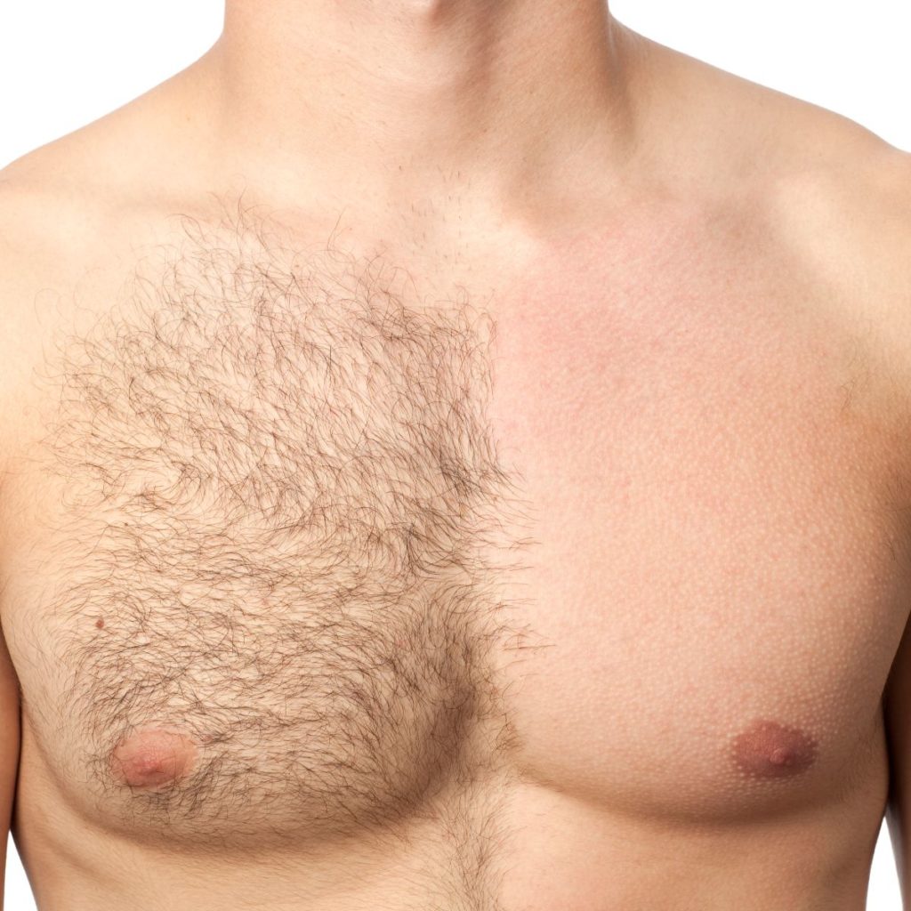 reasons 2021 should be all about unwanted hair 63af3de5cc924