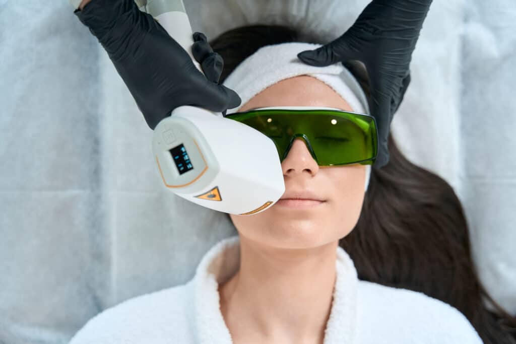 Close up photo of face laser hair removal procedure