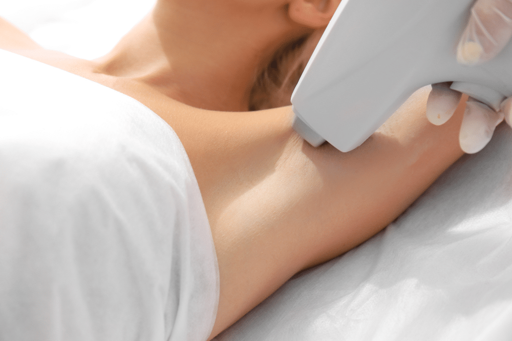 laser hair removal