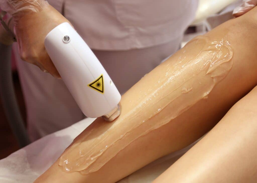 Laser Hair Removal Devices