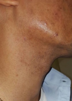 After Image