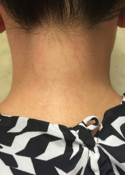 After Image